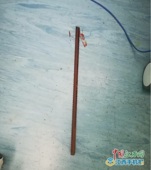 一男子被1米长钢筋刺穿口腔情况危急 一男子被1米长钢筋刺穿口腔情况危急