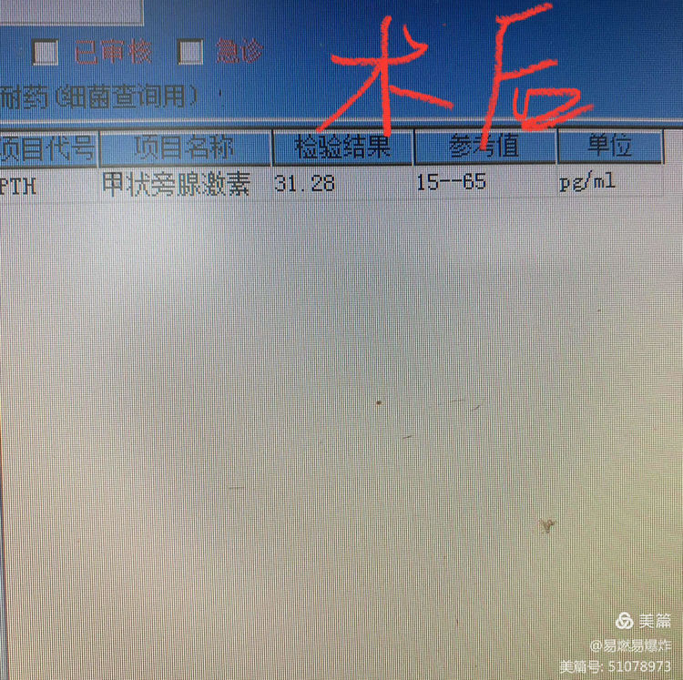 我院胸外科成功独立完成抚州首例双侧甲状旁腺全切除+自体甲状旁腺移植术 我院胸外科成功独立完成抚州首例双侧甲状旁腺全切除+自体甲状旁腺移植术